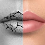 Dealing Chapped Lips