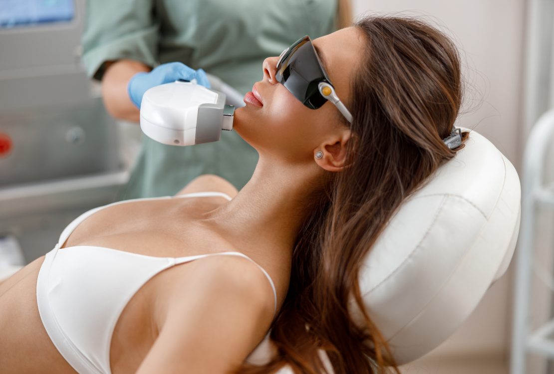 IPL Treatment